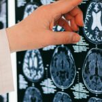 How Trauma Hijacks Your Brain (and How EMDR Can Help)